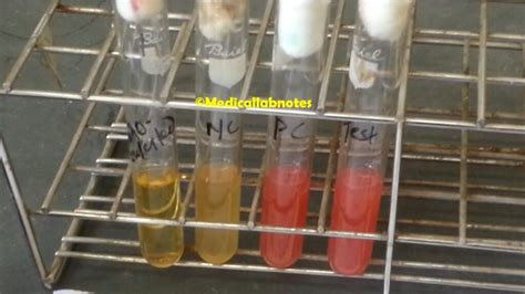 what happens to e. coli during and mr/vp test|1.27: MR.